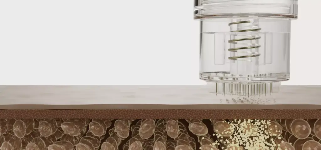 Diagrama del dispositivo de microagujas penetrando la capa de la piel, render de packaging cosmético