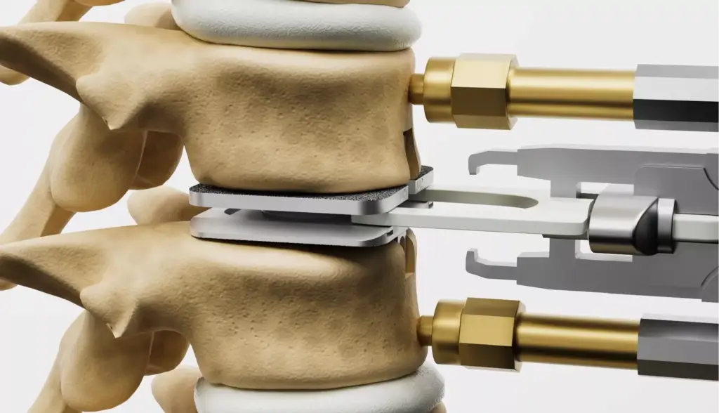 animation-for-medical-education-spinal-implant-placement