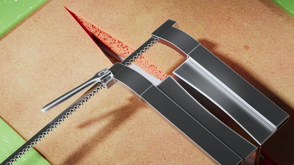 3D surgical animation still of a retractor holding open an incision through skin and fat layers