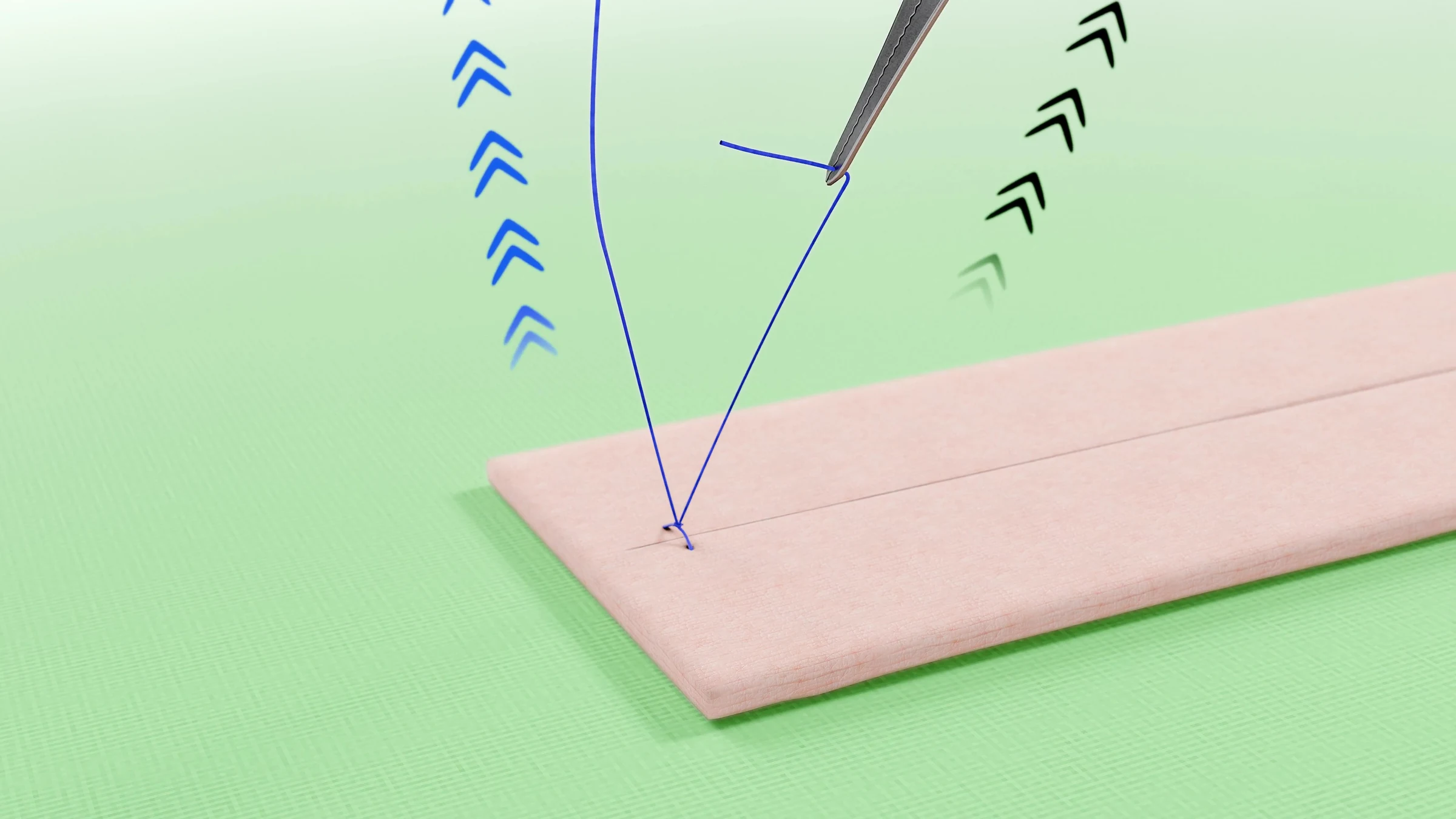 Tightened knot on the incision, with blue and green arrows showing the pull on both suture ends