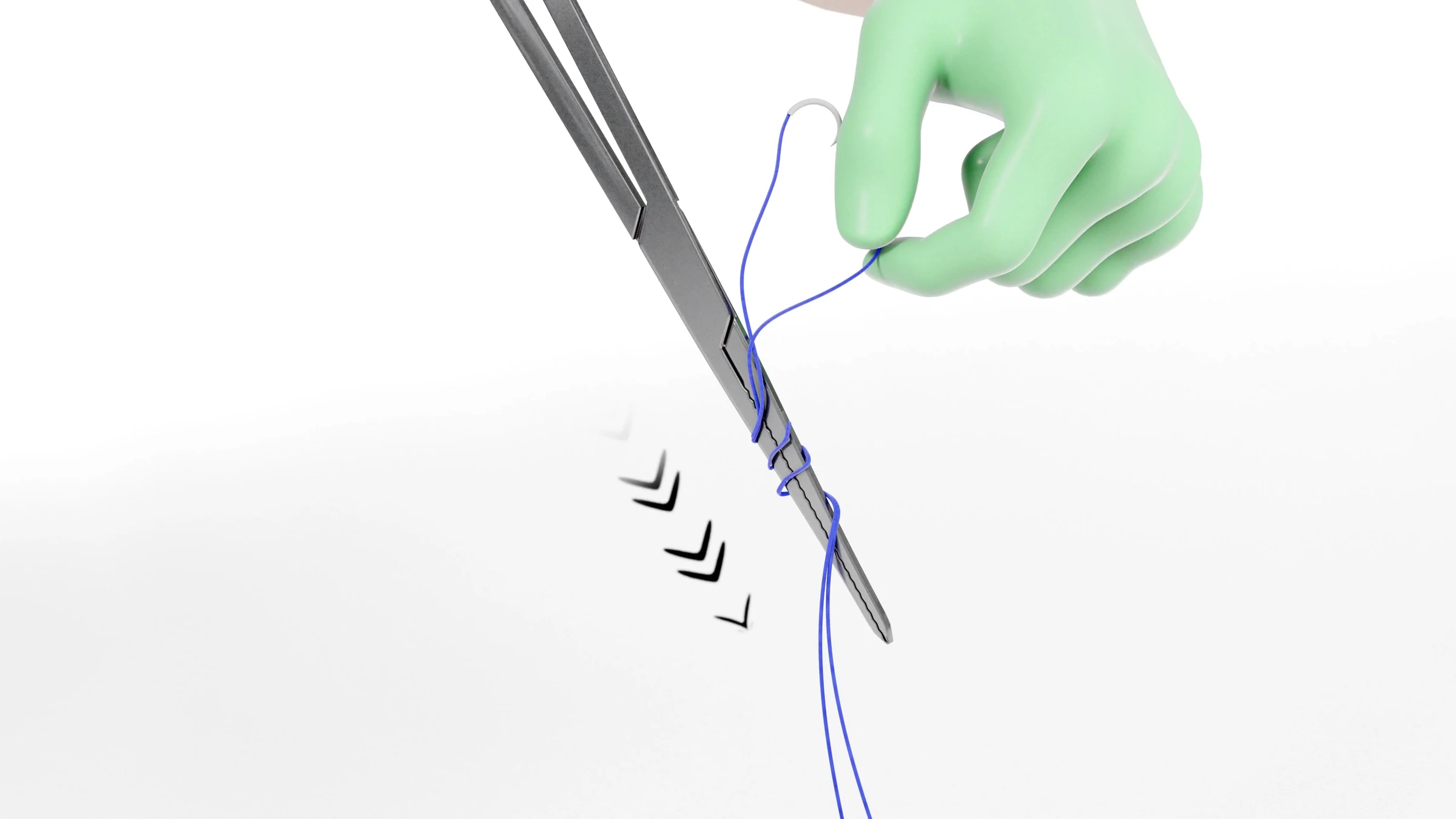 Close-up of a vertical needle driver with the suture fed by a gloved hand
