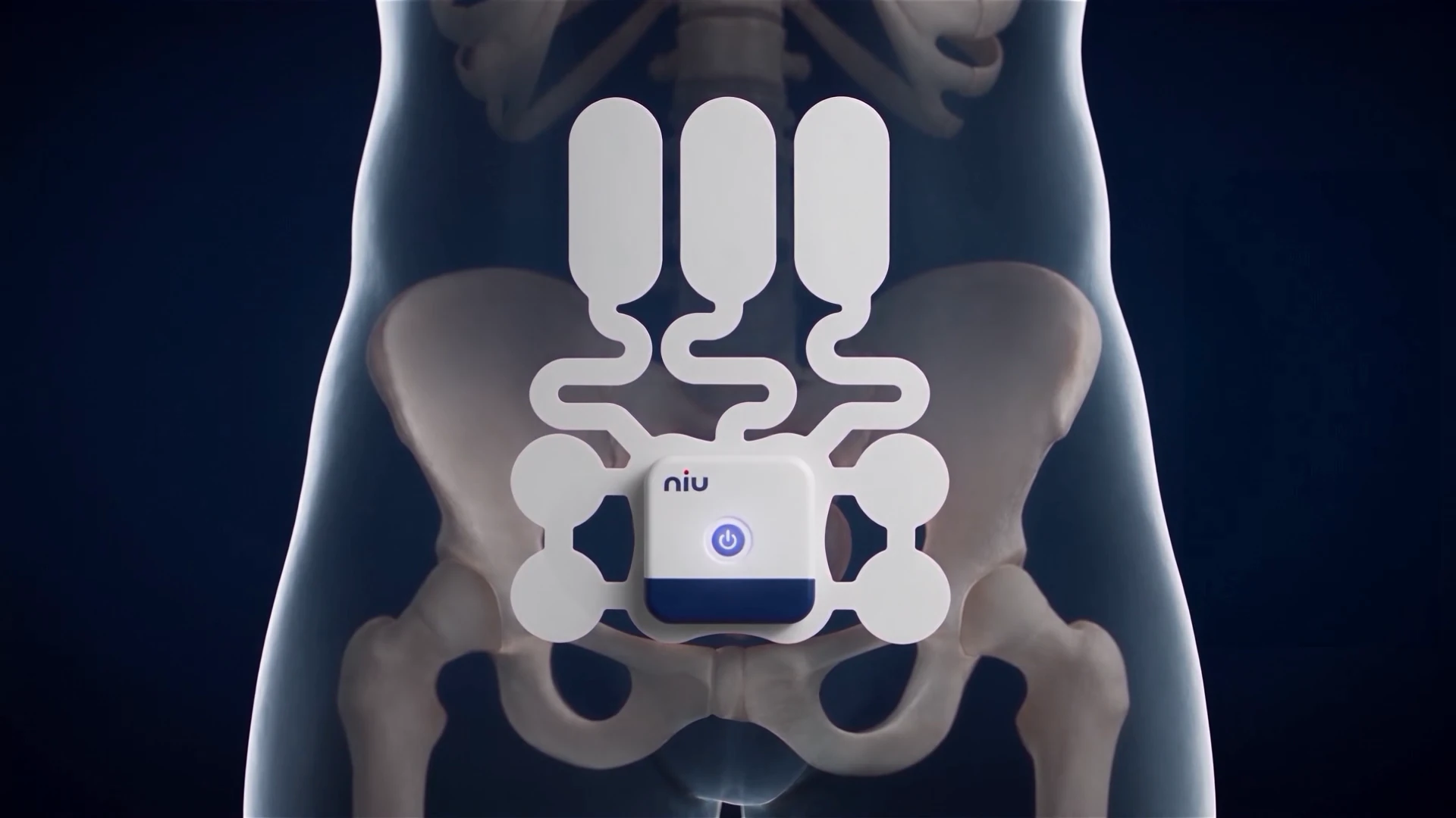 Pelvis appearing in an X-ray view behind the wearable monitor and its sensor film