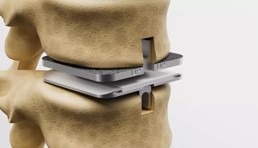 Spine model side view anatomy 3D Surgery animation vertebrae structure display