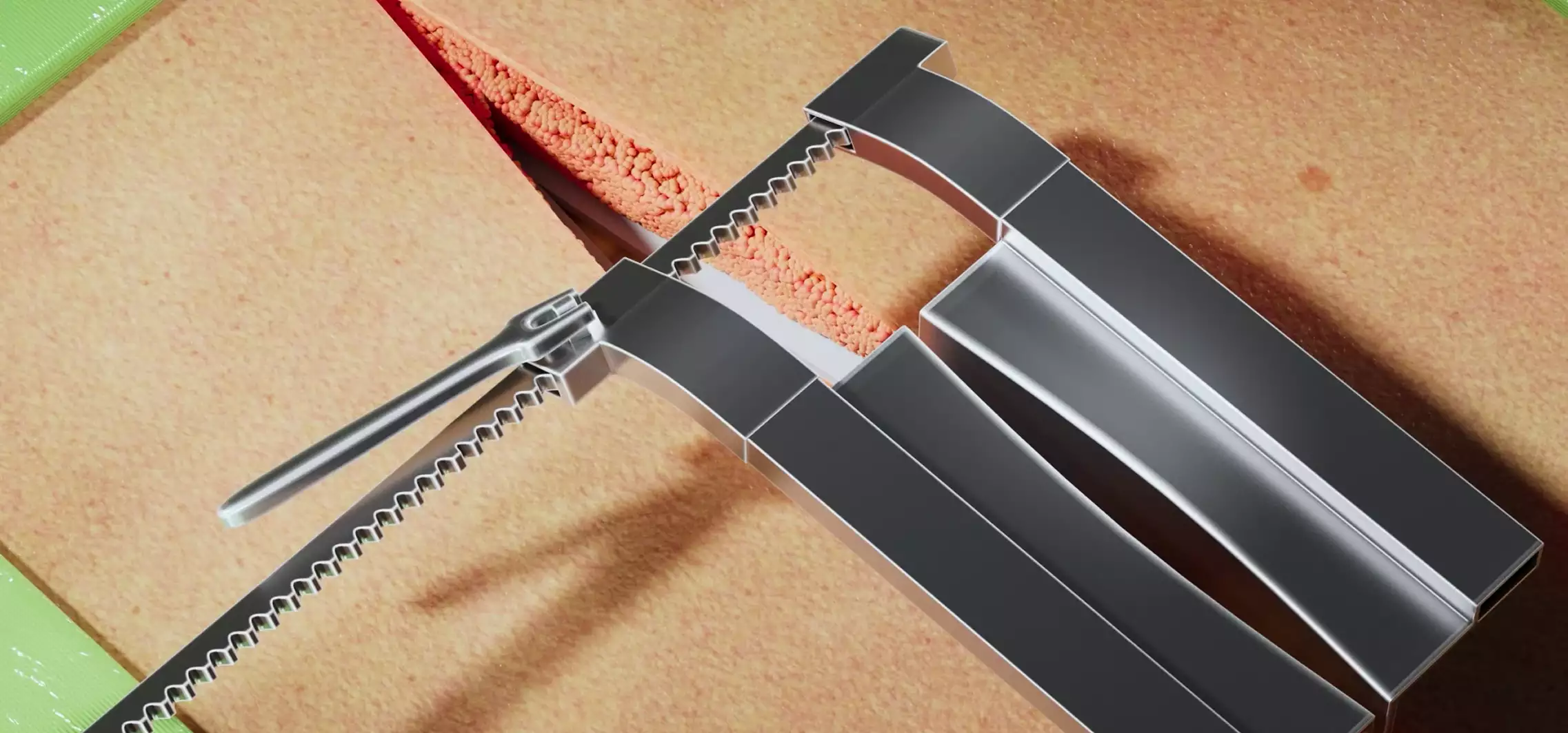 Surgical clamp holding vertebra implant 3D Surgery animation spinal procedure step